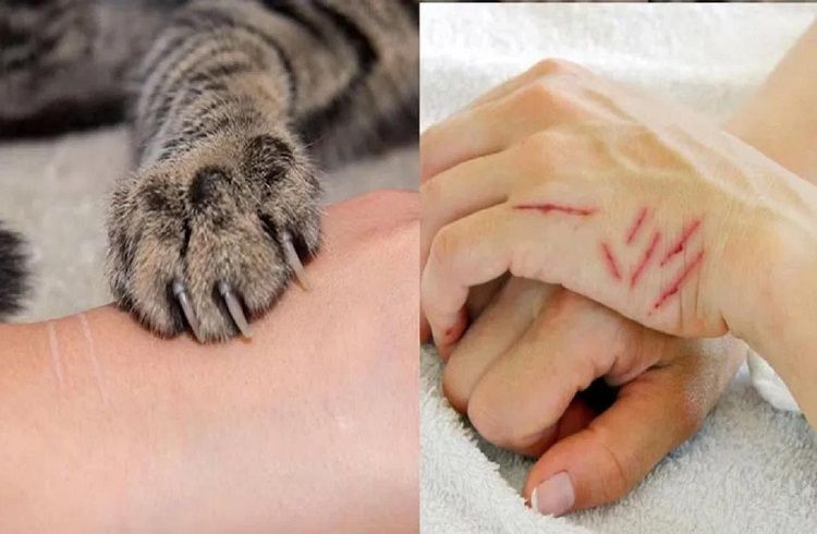 SHOCKING : ಮನೆಯಲ್ಲಿ ಬೆಕ್ಕು ಸಾಕುವವರೇ ಎಚ್ಚರ : ಬೆಕ್ಕು ಕೈ ಪರಚಿ ಯುವಕ ಸಾವು.!