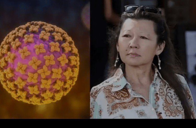 ನಟ ಜೀನ್ ಹ್ಯಾಕ್ಮನ್ ಪತ್ನಿಯನ್ನು ಕೊಂದ ಅಪರೂಪದ ಕಾಯಿಲೆ ‘ಹ್ಯಾಂಟವೈರಸ್’ ಎಂದರೇನು? ಇಲ್ಲಿದೆ ಮಾಹಿತಿ |Hantavirus