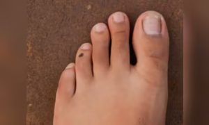 Do you know what happens if your index toe is longer than your thumb