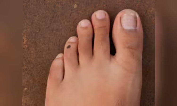 Do you know what happens if your index toe is longer than your thumb