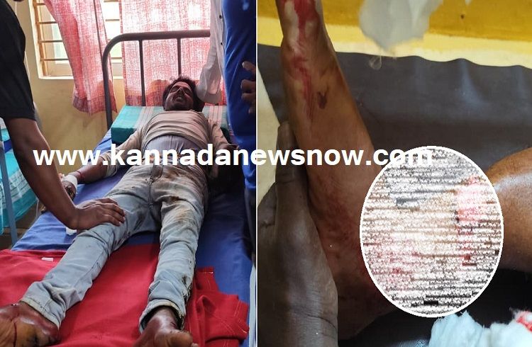 ಶಿವಮೊಗ್ಗ: ಇಂದು ಸೊರಬದ ಉಳವಿಯಲ್ಲಿ ಎರಡು ದುರ್ಘಟನೆ, ಇಬ್ಬರಿಗೆ ಗಂಭೀರ ಗಾಯ