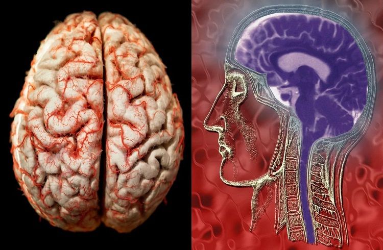 ಕೇರಳದಲ್ಲಿ ಆತಂಕ ಸೃಷ್ಟಿಸಿದ `ಮೆದುಳು ತಿನ್ನುವ ಅಮೀಬಾ’ : ಈ ಸೋಂಕಿನ ಲಕ್ಷಣಗಳು, ಮುನ್ನೆಚ್ಚರಿಕೆ ಕ್ರಮಗಳೇನು ತಿಳಿಯಿರಿ.!