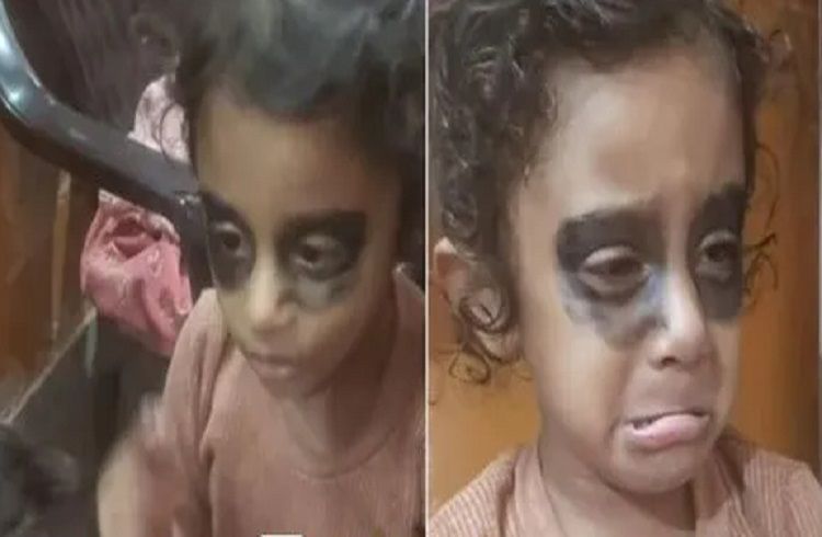 ಪೋಷಕರೇ ಗಮನಿಸಿ : ನಿಮ್ಮ ಮಕ್ಕಳು `ಮೊಬೈಲ್’ ನೋಡುವುದನ್ನು ತಪ್ಪಿಸಲು ಜಸ್ಟ್ ಹೀಗೆ ಮಾಡಿ | WATCH VIDEO