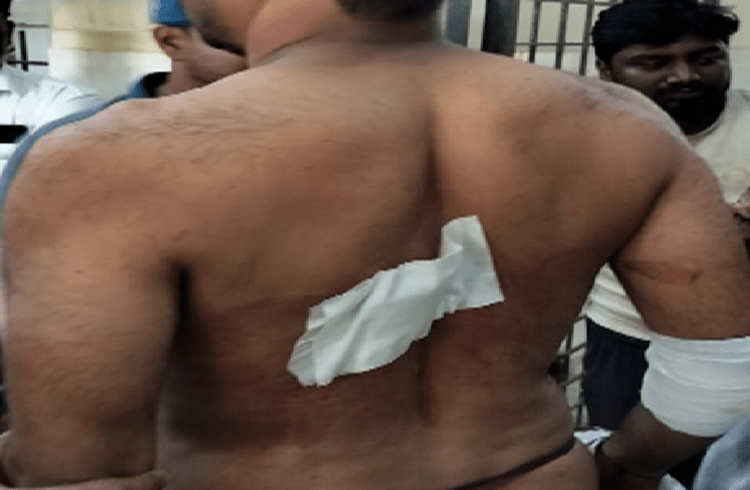 ಮಂಡ್ಯದಲ್ಲಿ ಯುವಕನ ಮೇಲೆ ಮಾರಕಾಸ್ತ್ರಗಳಿಂದ ಕೊಚ್ಚಿ ಕೊಲೆ ಯತ್ನ ; ಪ್ರಾಣಾಪಾಯದಿಂದ ಪಾರು!