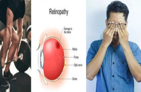 ALERT : `ಜಿಮ್’ಗೆ ಹೋಗುವ ಯುವಕರೇ ಎಚ್ಚರ : `ವರ್ಕೌಟ್’ ಮಾಡುವಾಗಲೇ `ದೃಷ್ಠಿ’ ಕಳೆದುಕೊಂಡ ಯುವಕ.!