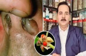 ಗಮನಿಸಿ : ಮೂಗಿನಲ್ಲಿ ದುರ್ಮಾಂಸ ಬೆಳೆದು ಉಸಿರಾಡಲು ಕಷ್ಟವಾಗುತ್ತಿದೆಯೇ? ಈ ಟಿಪ್ಸ್ ಫಾಲೋ ಮಾಡಿ.!