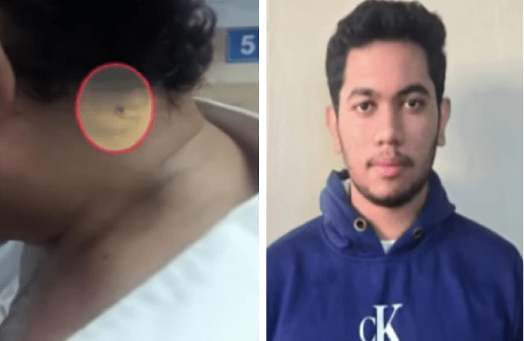 ಬೆಂಗಳೂರಲ್ಲಿ ಉದ್ಯಮಿ ರಾಜಗೋಪಾಲ್ ಮೇಲೆ ಏರ್ ಗನ್ ನಿಂದ ಫೈರಿಂಗ್ ಕೇಸ್ : ಆರೋಪಿ ಅಫ್ಜಲ್ ಅರೆಸ್ಟ್