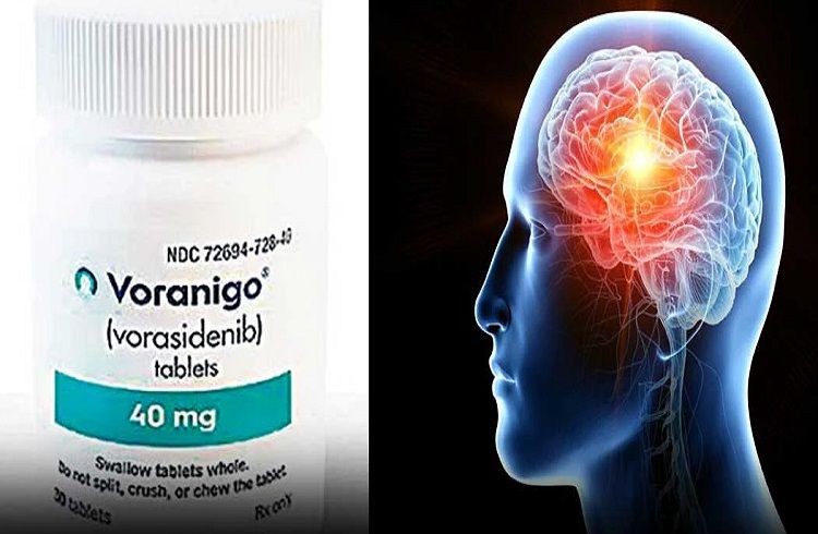 GOOD NEWS : 25 ವರ್ಷಗಳ ನಂತರ ಭಾರತದಲ್ಲಿ `ಮೆದುಳಿನ ಕ್ಯಾನ್ಸರ್’ ಚಿಕಿತ್ಸೆಗೆ ಹೊಸ ಔಷಧ ಲಭ್ಯ.!
