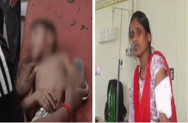 ಧಾರವಾಡದಲ್ಲಿ ಹುಚ್ಚು ನಾಯಿ ಭೀಕರ ದಾಳಿ : ಮಹಿಳೆಯರು, ಮಕ್ಕಳು ಸೇರಿ 9 ಜನರಿಗೆ ಗಂಭೀರ ಗಾಯ