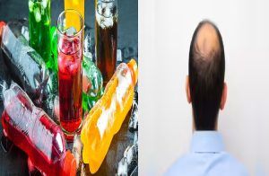 ALERT : ಪುರುಷರೇ ಎಚ್ಚರ : ಅತಿಯಾಗಿ `ಸಿಹಿ ಪಾನೀಯ’ ಸೇವಿಸಿದ್ರೆ ಕೂದಲು ಉದುರಿ ತಲೆ ಬೋಳಾಗುತ್ತೆ.!