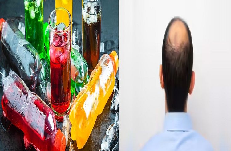 ALERT : ಪುರುಷರೇ ಎಚ್ಚರ : ಅತಿಯಾಗಿ `ಸಿಹಿ ಪಾನೀಯ’ ಸೇವಿಸಿದ್ರೆ ಕೂದಲು ಉದುರಿ ತಲೆ ಬೋಳಾಗುತ್ತೆ.!