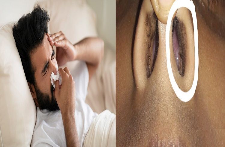 ಮೂಗಿನಲ್ಲಿ ದುರ್ಮಾಂಸ ಬೆಳೆದು ಉಸಿರಾಡಲು ಕಷ್ಟವಾಗುತ್ತಿದೆಯೇ? ಜಸ್ಟ್ ಈ ಟಿಪ್ಸ್ ಫಾಲೋ ಮಾಡಿ