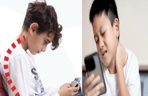 ALERT : ಪೋಷಕರೇ ಎಚ್ಚರ : `ಮೊಬೈಲ್’ ನೋಡುವುದರಿಂದ ಮಕ್ಕಳಲ್ಲಿ ಹೆಚ್ಚುತ್ತಿದೆ `ಟೆಕ್ಸ್ಟ್ ನೆಕ್’ ಸಮಸ್ಯೆ.!