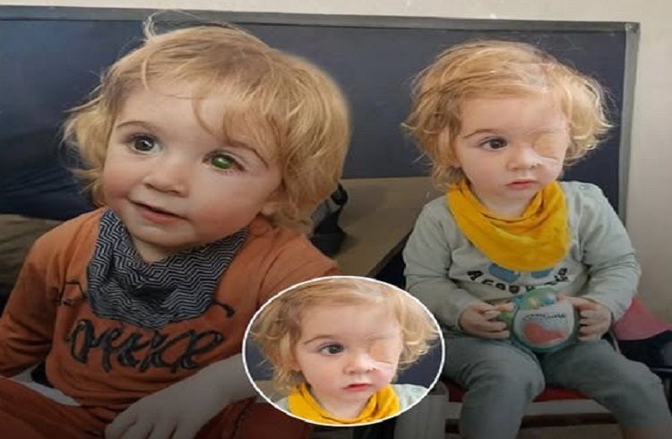 SHOCKING : ಪುಟ್ಟ ಮಕ್ಕಳಿಗೆ `ಚುಂಬಿಸುವ’ ಮುನ್ನ ಎಚ್ಚರ : ಅಪಾಯಕಾರಿ ಸೋಂಕಿನಿಂದ ದೃಷ್ಟಿ ಕಳೆದುಕೊಂಡ 2 ವರ್ಷದ ಮಗು !