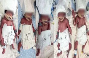 OMG : ಒಂದೇ ಹೆರಿಗೆಯಲ್ಲಿ 5 ಮಕ್ಕಳಿಗೆ ಜನ್ಮ ನೀಡಿದ ಮಹಾತಾಯಿ !