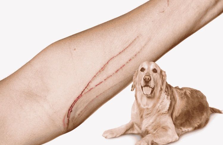 ALERT : ನಾಯಿಗಳು ಉಗುರುಗಳಿಂದ ಪರಚಿದ್ರೂ `ರೇಬಿಸ್ ಸೋಂಕು’ ಬರಬಹುದು ಎಚ್ಚರ !