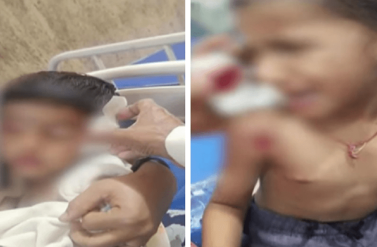 BIG NEWS : ಕಲ್ಬುರ್ಗಿಯಲ್ಲಿ ಐವರು ಮಕ್ಕಳ ಮೇಲೆ ಹುಚ್ಚು ನಾಯಿ ದಾಳಿ : ಕಿವಿ, ಕಣ್ಣು, ಎದೆ ಭಾಗಗಳಿಗೆ ಗಂಭೀರ ಗಾಯ!