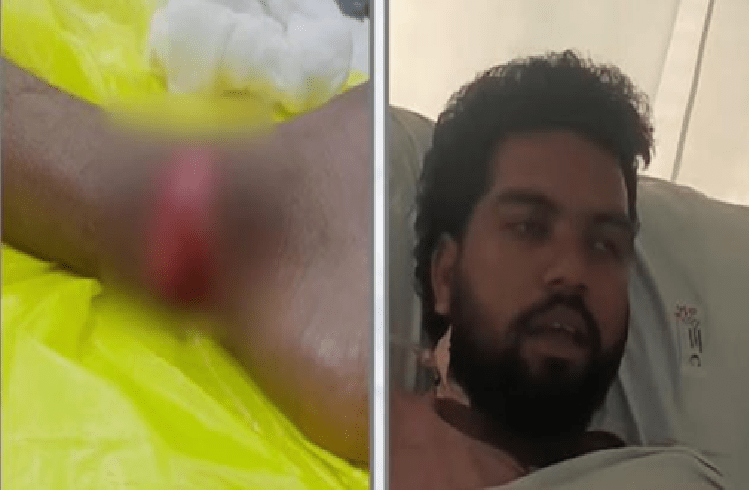 SHOCKING : ಬೆಂಗಳೂರಲ್ಲಿ ಗಾಳಿಪಟದ ದಾರ ಕಾಲಿಗೆ ಸಿಲುಕಿ, ವ್ಯಕ್ತಿಯ ಕಾಲಿನ ನರ ಕಟ್!