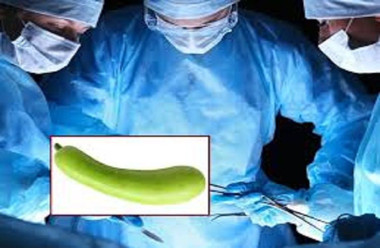 SHOCKING : ಯುವಕನ ಖಾಸಗಿ ಅಂಗದಲ್ಲಿ `ಸೋರೆಕಾಯಿ’ : `ಎಕ್ಸ್ ರೇ’ ನೋಡಿ ವೈದ್ಯರೇ ಶಾಕ್ !