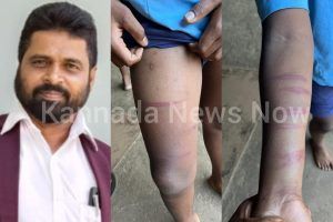 ಸಾಗರದಲ್ಲಿ ವಿದ್ಯಾರ್ಥಿ ಮೇಲೆ ಶಿಕ್ಷಕರಿಂದ ಹಲ್ಲೆ; ಕ್ರಿಮಿನಲ್ ಕೇಸ್ ದಾಖಲಿಸಲು ಜಿಟಿ ಸತ್ಯನಾರಾಯಣ ಒತ್ತಾಯ