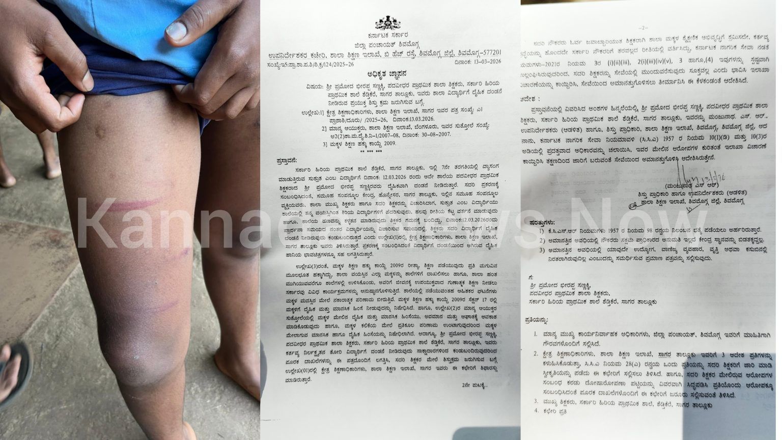 ಸಾಗರದ ಶೆಡ್ತೀಕೆರೆ ಶಾಲೆಯಲ್ಲಿ ವಿದ್ಯಾರ್ಥಿ ಮೇಲೆ ಹಲ್ಲೆ ಘಟನೆ: ಶಿಕ್ಷಕ ಪ್ರಮೋದ್ ಸಣ್ಣಕ್ಕಿ ಸಸ್ಪೆಂಡ್