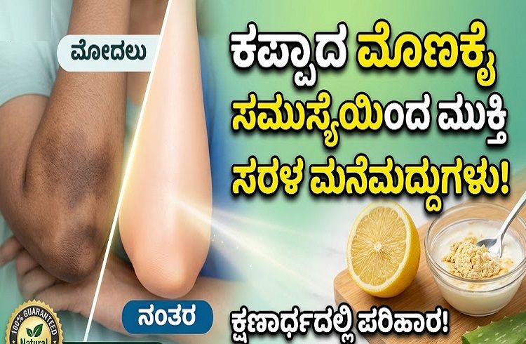 ಕಪ್ಪಾದ ಮೊಣಕೈ ಸಮಸ್ಯೆಯಿಂದ ಮುಕ್ತಿ ಪಡೆಯಲು ಇಲ್ಲಿವೆ ಸರಳ ಮನೆಮದ್ದುಗಳು!