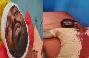 ಮಂಡ್ಯದ ಮದ್ದೂರಿನಲ್ಲಿ ಭೀಕರ ಗ್ಯಾಂಗ್ ವಾರ್: ರೌಡಿಶೀಟರ್ ಹತ್ಯೆ, ಇಬ್ಬರ ಸ್ಥಿತಿ ಗಂಭೀರ