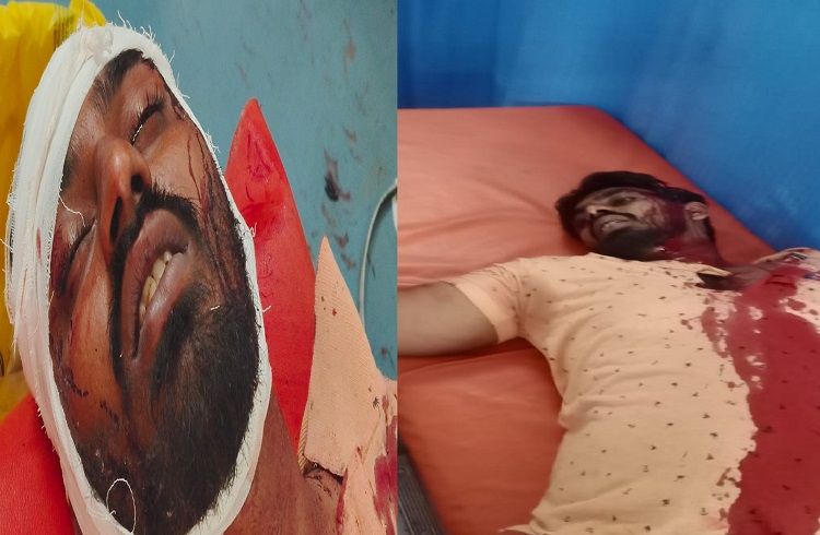 ಮಂಡ್ಯದ ಮದ್ದೂರಿನಲ್ಲಿ ಭೀಕರ ಗ್ಯಾಂಗ್ ವಾರ್: ರೌಡಿಶೀಟರ್ ಹತ್ಯೆ, ಇಬ್ಬರ ಸ್ಥಿತಿ ಗಂಭೀರ