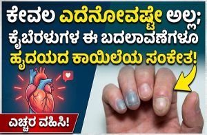 ಕೇವಲ ಎದೆನೋವಷ್ಟೇ ಅಲ್ಲ, ಕೈಬೆರಳುಗಳ ಈ ಬದಲಾವಣೆಗಳೂ ಹೃದಯದ ಕಾಯಿಲೆಯ ಸಂಕೇತ!