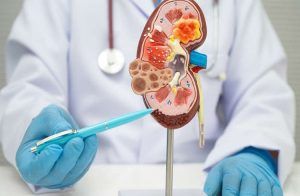 Kidney damage: ಇವು ಮೂತ್ರಪಿಂಡಗಳ ರಕ್ಷಣೆಗೆ ತಜ್ಞರು ಸೂಚಿಸುವ 8 ಸುವರ್ಣ ನಿಯಮಗಳು